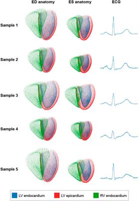 Multi-Domain Variational Autoencoders for Combined Modeling of MRI-Based Biventricular Anatomy and ECG-Based Cardiac Electrophysiology